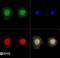 Transient Receptor Potential Cation Channel Subfamily M Member 2 antibody, NB110-82364, Novus Biologicals, Immunocytochemistry image 