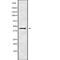 Testis Specific Serine Kinase 1B antibody, PA5-67709, Invitrogen Antibodies, Western Blot image 