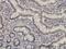Myocyte Enhancer Factor 2A antibody, H00004205-M01, Novus Biologicals, Immunohistochemistry frozen image 