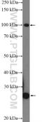 PPARG Coactivator 1 Alpha antibody, 20658-1-AP, Proteintech Group, Western Blot image 