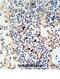 Immunoglobulin Kappa Variable 1D-16 antibody, abx025345, Abbexa, Immunohistochemistry paraffin image 