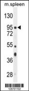 NOP2/Sun RNA Methyltransferase 2 antibody, 55-438, ProSci, Western Blot image 