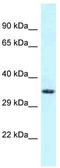 Fibronectin Type III And SPRY Domain Containing 1 Like antibody, TA342990, Origene, Western Blot image 