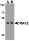 Serine/Threonine Kinase 17b antibody, A08711, Boster Biological Technology, Western Blot image 