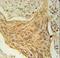 Chondrosarcoma-associated gene 2/3 protein antibody, LS-C167075, Lifespan Biosciences, Immunohistochemistry paraffin image 