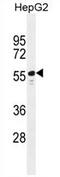 Tetratricopeptide Repeat Domain 6 antibody, AP54400PU-N, Origene, Western Blot image 