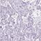 Cilia And Flagella Associated Protein 52 antibody, HPA023247, Atlas Antibodies, Immunohistochemistry paraffin image 