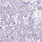 WD repeat-containing protein 16 antibody, HPA023247, Atlas Antibodies, Immunohistochemistry paraffin image 