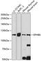 EPH Receptor B6 antibody, GTX66283, GeneTex, Western Blot image 