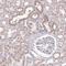 Centrosomal Protein 164 antibody, HPA037606, Atlas Antibodies, Immunohistochemistry paraffin image 