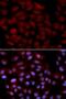 Activated CDC42 kinase 1 antibody, LS-B12327, Lifespan Biosciences, Immunofluorescence image 