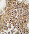 ALK Receptor Tyrosine Kinase antibody, abx033503, Abbexa, Immunohistochemistry frozen image 