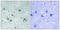 Dihydropyrimidinase Like 2 antibody, LS-C198844, Lifespan Biosciences, Immunohistochemistry paraffin image 