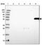 Gamma-Glutamyltransferase 2 antibody, PA5-61540, Invitrogen Antibodies, Western Blot image 