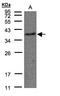 Thromboxane A2 Receptor antibody, LS-B4842, Lifespan Biosciences, Western Blot image 