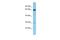 Proline Rich Protein BstNI Subfamily 3 antibody, A11468, Boster Biological Technology, Western Blot image 