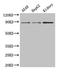 Aspartate Beta-Hydroxylase antibody, LS-B11904, Lifespan Biosciences, Western Blot image 