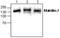 Matrilin 2 antibody, GTX59785, GeneTex, Western Blot image 