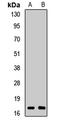 RNA Binding Motif Protein 3 antibody, LS-C667990, Lifespan Biosciences, Western Blot image 