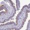Tetratricopeptide Repeat Domain 30B antibody, HPA052487, Atlas Antibodies, Immunohistochemistry paraffin image 