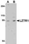 Leucine Zipper Like Transcription Regulator 1 antibody, LS-C108666, Lifespan Biosciences, Western Blot image 