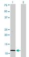 S100 Calcium Binding Protein A1 antibody, H00006271-M01, Novus Biologicals, Western Blot image 