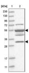 Transmembrane Protein With Metallophosphoesterase Domain antibody, NBP1-93749, Novus Biologicals, Western Blot image 