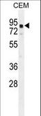 Galactosidase Beta 1 Like 2 antibody, LS-C166495, Lifespan Biosciences, Western Blot image 