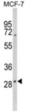 Iodothyronine Deiodinase 2 antibody, AP17989PU-N, Origene, Western Blot image 