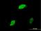 Early Growth Response 1 antibody, H00001958-M03, Novus Biologicals, Immunocytochemistry image 