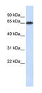 Frizzled Class Receptor 4 antibody, 25-683, ProSci, Western Blot image 