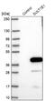 Estrogen sulfotransferase antibody, NBP1-84785, Novus Biologicals, Western Blot image 