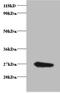 Tissue Specific Transplantation Antigen P35B antibody, A53877-100, Epigentek, Western Blot image 