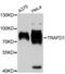 TRAF-Type Zinc Finger Domain Containing 1 antibody, LS-C748137, Lifespan Biosciences, Western Blot image 