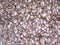 Thyroglobulin antibody, LS-C339046, Lifespan Biosciences, Immunohistochemistry frozen image 