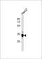 Dickkopf WNT Signaling Pathway Inhibitor 1 antibody, MBS9203825, MyBioSource, Western Blot image 