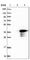 Cilia And Flagella Associated Protein 298 antibody, HPA028849, Atlas Antibodies, Western Blot image 