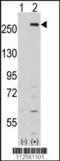 Lemur Tyrosine Kinase 2 antibody, 62-682, ProSci, Western Blot image 