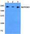 Notch Receptor 3 antibody, A00485-1, Boster Biological Technology, Western Blot image 