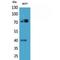 MPL Proto-Oncogene, Thrombopoietin Receptor antibody, LS-C387224, Lifespan Biosciences, Western Blot image 