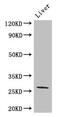 Gap Junction Protein Beta 2 antibody, CSB-PA009452LA01HU, Cusabio, Western Blot image 