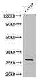 Connexin-26 antibody, CSB-PA009452LA01HU, Cusabio, Western Blot image 