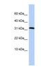 Protein Phosphatase 1 Regulatory Subunit 27 antibody, NBP1-55525, Novus Biologicals, Western Blot image 