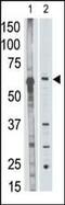 Matrix metalloproteinase-25 antibody, PA5-13191, Invitrogen Antibodies, Western Blot image 