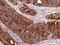 Carcinoembryonic Antigen Related Cell Adhesion Molecule 6 antibody, 10823-T24, Sino Biological, Immunohistochemistry frozen image 
