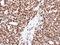 SET Nuclear Proto-Oncogene antibody, NBP1-33713, Novus Biologicals, Immunohistochemistry paraffin image 