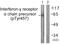 Interferon Gamma Receptor 1 antibody, PA5-38504, Invitrogen Antibodies, Western Blot image 
