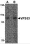 VPS53 Subunit Of GARP Complex antibody, 4595, ProSci, Western Blot image 