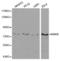 Inhibitor Of Nuclear Factor Kappa B Kinase Subunit Beta antibody, LS-C331887, Lifespan Biosciences, Western Blot image 