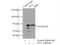 Neurofilament Light antibody, 12998-1-AP, Proteintech Group, Immunoprecipitation image 